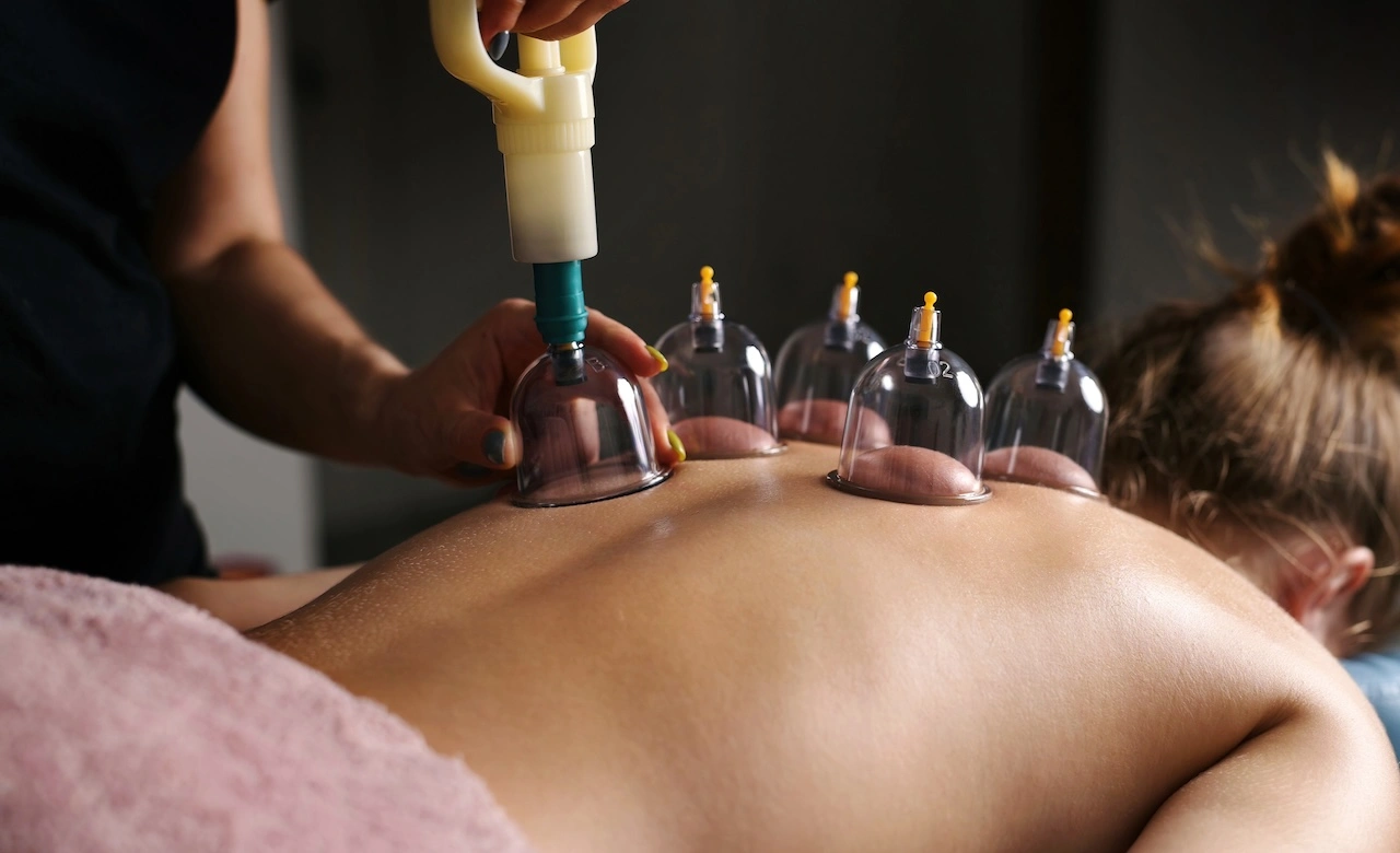 Cupping therapy session
